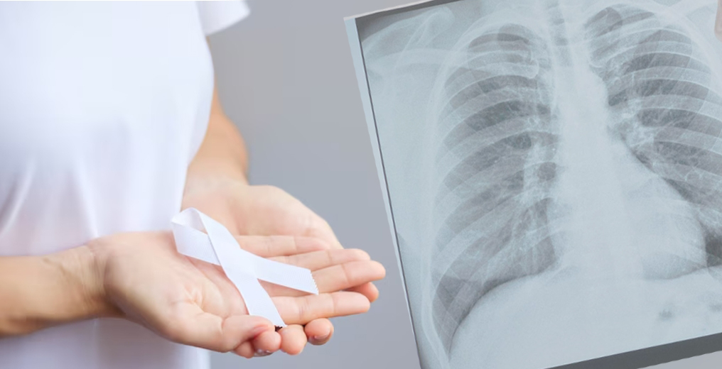 มะเร็งปอด